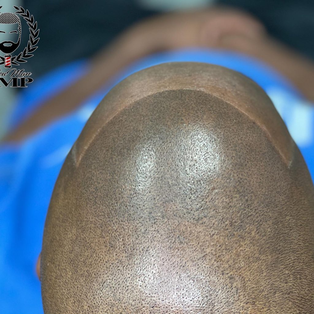 Unveiling the Artistry of Head Shaving with Scalp Tattoo in Atlanta, GA
