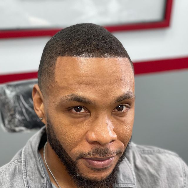 Discover Natural HairLike Effects Scalp Micropigmentation in Atlanta, GA