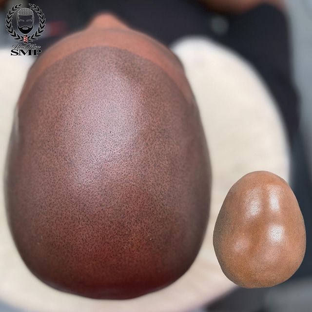 Discover Your Perfect Scalp Micropigmentation Style in Atlanta, GA