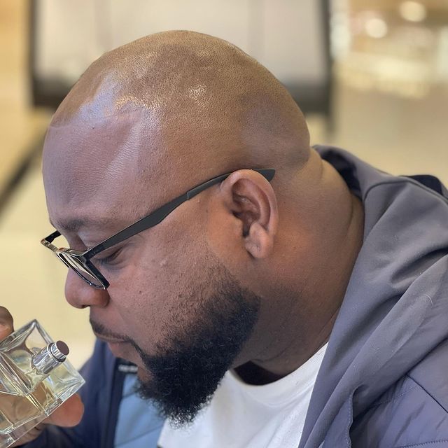 Transformative Scalp Micropigmentation in Atlanta, GA Unveiling Confidence