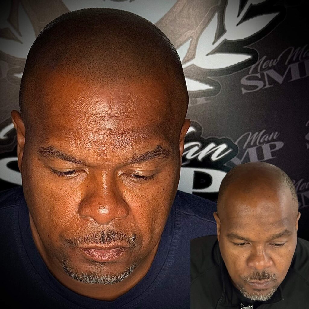 smp treatment doraville results